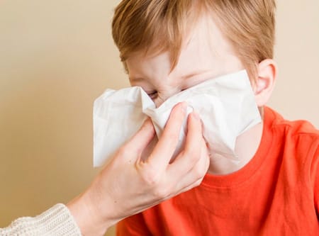 Alergija kod beba i dece