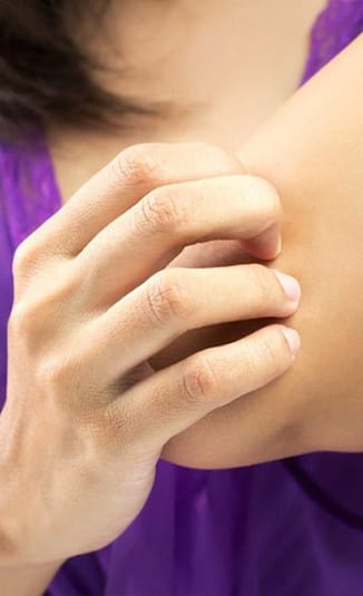 Svrab po telu - najčešći vesnik atopijskog dermatitisa