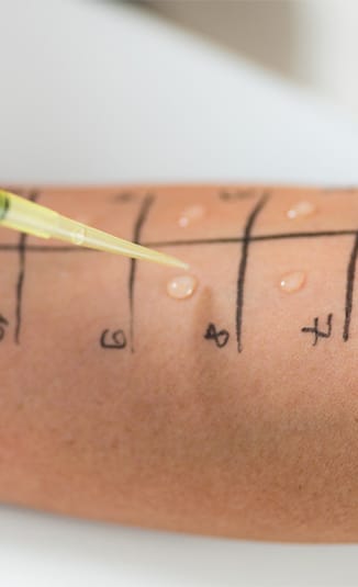 Test na alergije - Sve što treba da znate o zdravstvenim pregledima i analizama